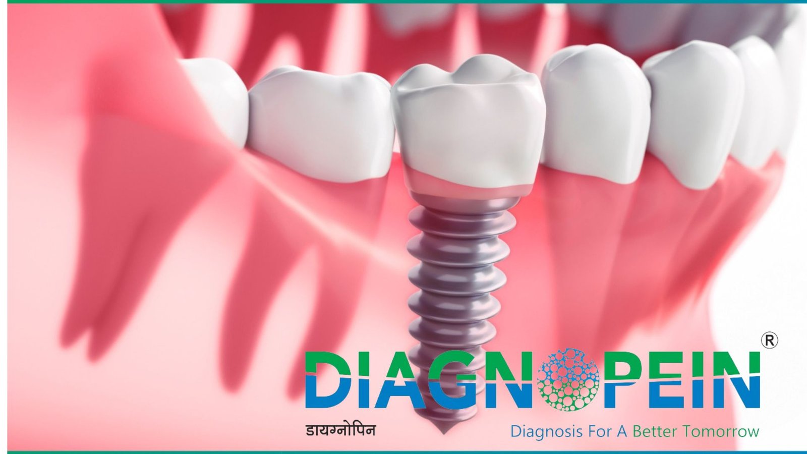 Best Dental Clinic In Mumbai | Braces, Aligners & Smile Makeovers