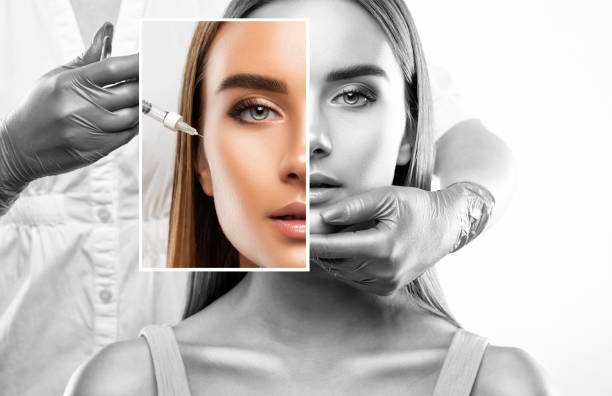 Botox Injections in Riyadh (1)