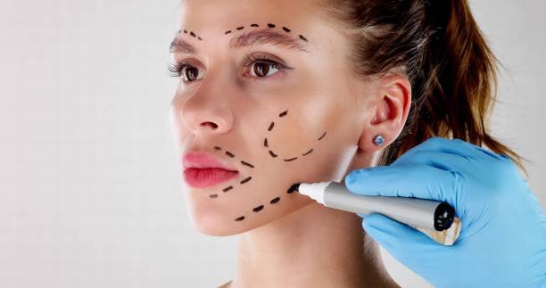 facelift in riyadh