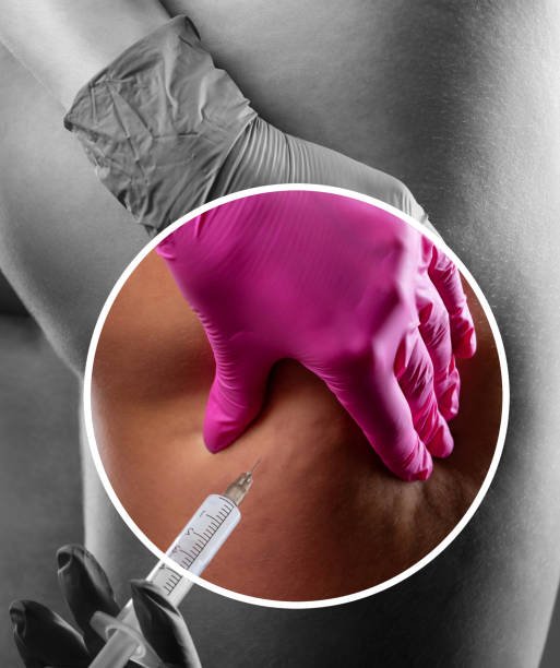 fat melting injections in riyadh