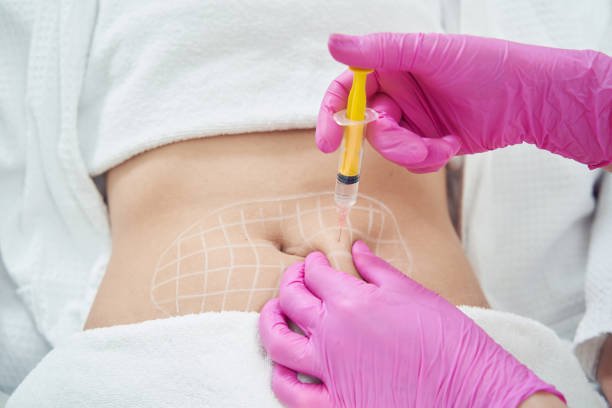Fat Melting Injections in Riyadh