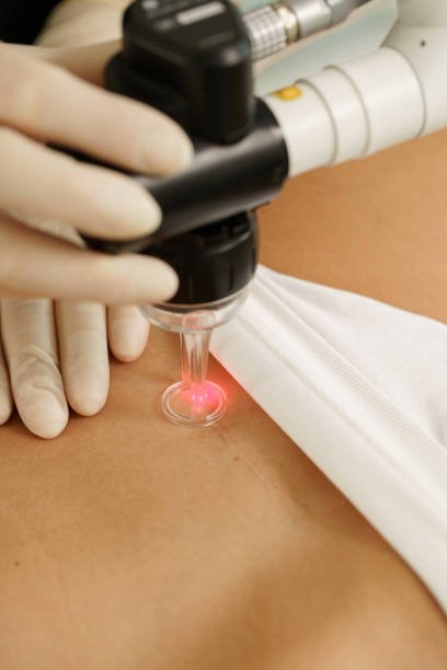 Fractional Laser Riyadh