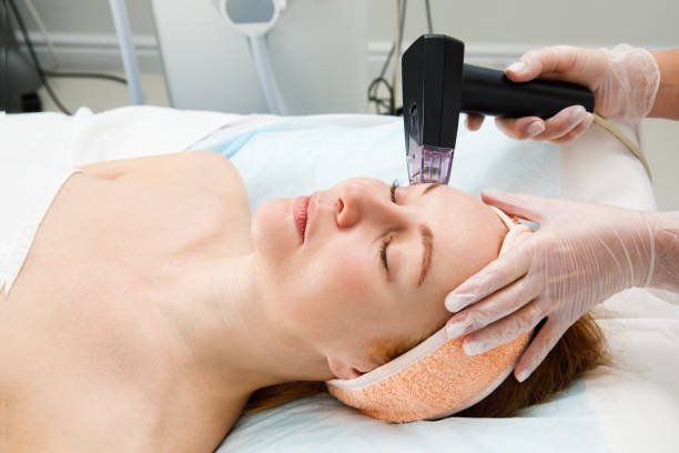 fractional laser in riyadh