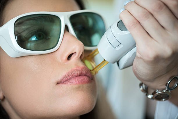 Laser hair Removal in Riyadh