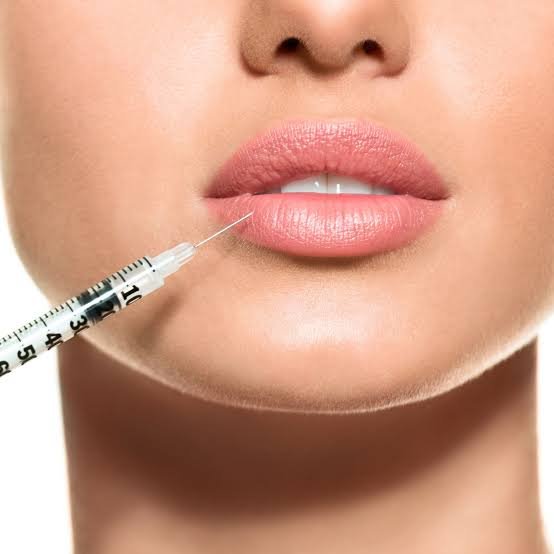 Lip Fillers in Riyadh