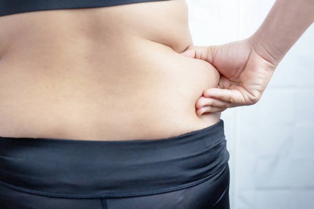 liposuction in riyadh