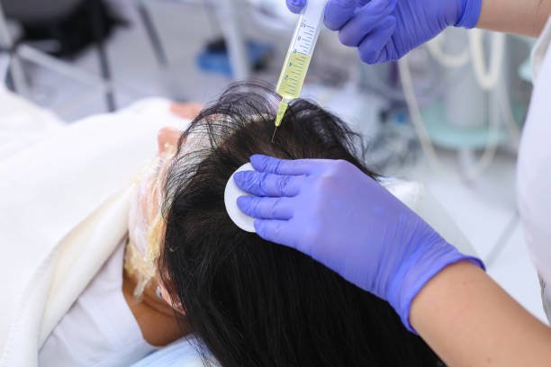 prp hair treatment in riyadh