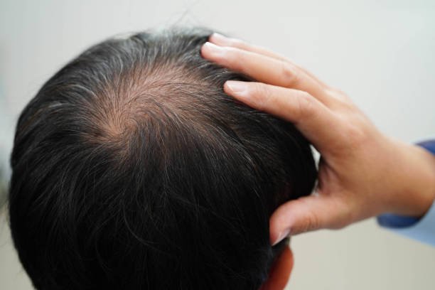 Stem cell therapy treatment in Riyadh