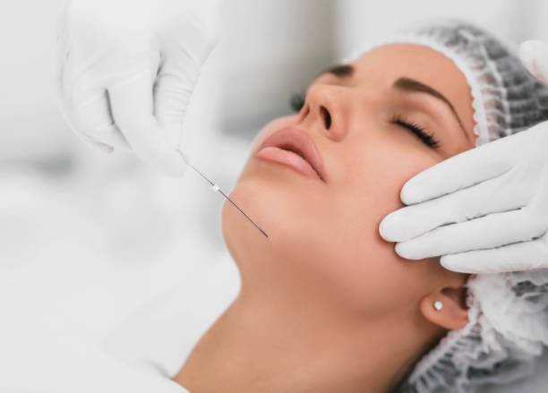 Thread Lift Treatment in Riyadh