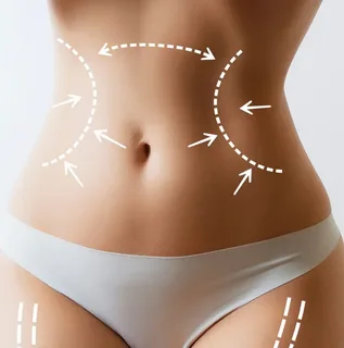 My Experience With Tummy Tuck Surgery in Riyadh