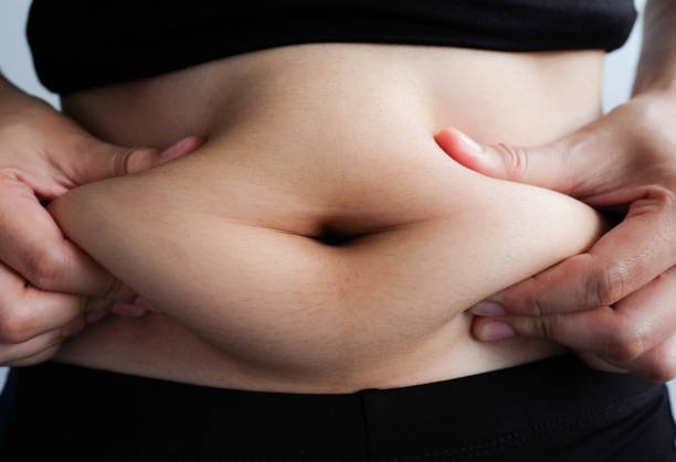 Tummy Tuck offer in Riyadh