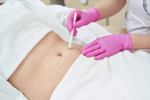 Fat Melting Injections in Riyadh