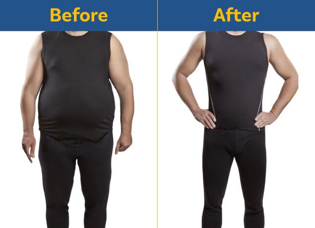 Bariatic surgery in islamabad