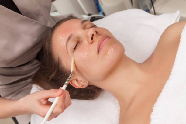 Chemical Peels in Riyadh