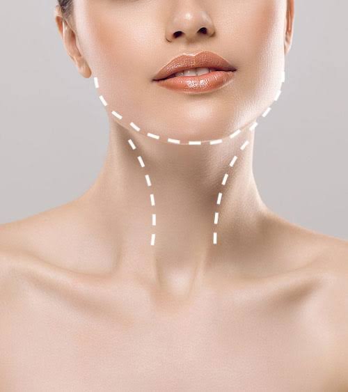 Double Chin Liposuction in Riyadh