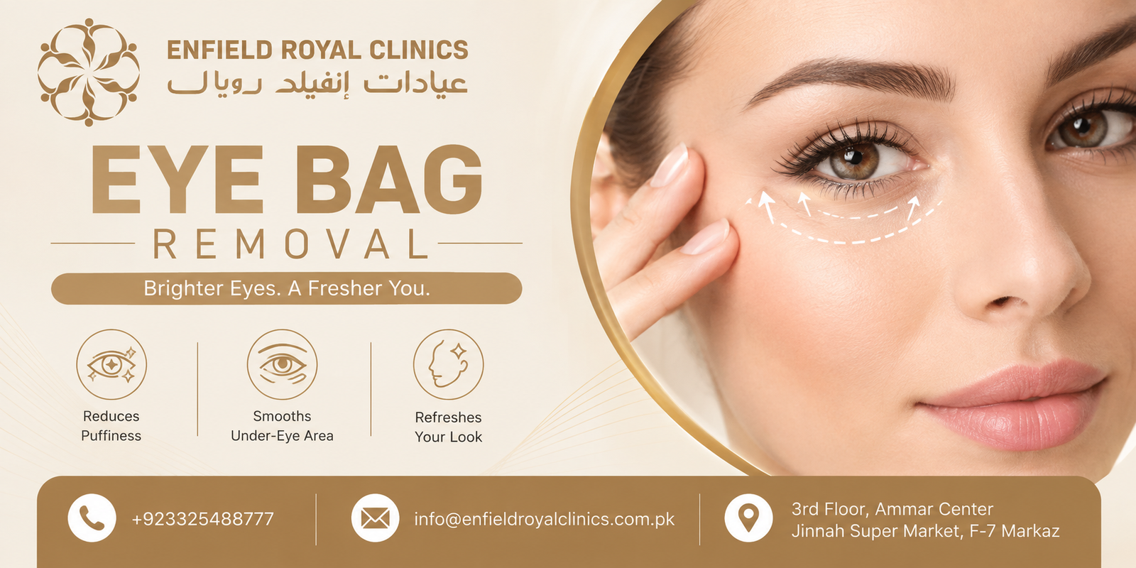 Eye Bag Removal