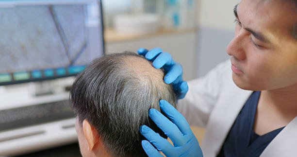 Hair Loss Treatment in Dubai