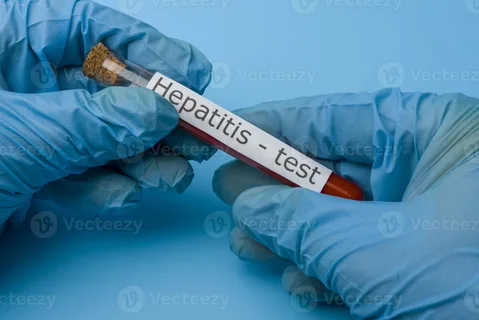 Hepatitis Blood Test