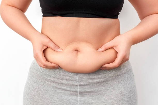 Liposuction Prices in Saudi Arabia: What to Expect