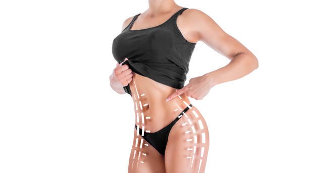 Liposuction in Riyadh