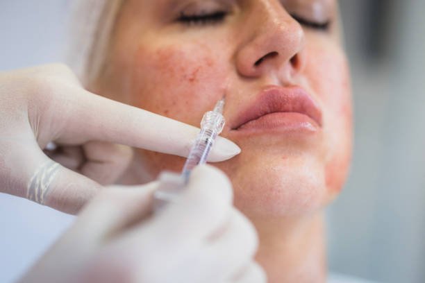 Liquid Facelift in Dubai