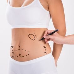 Liposuction in Saudi Arabia