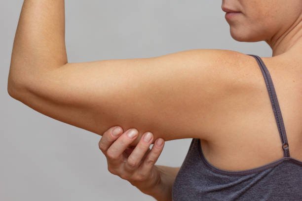 Arm Lift Surgery in Riyadh