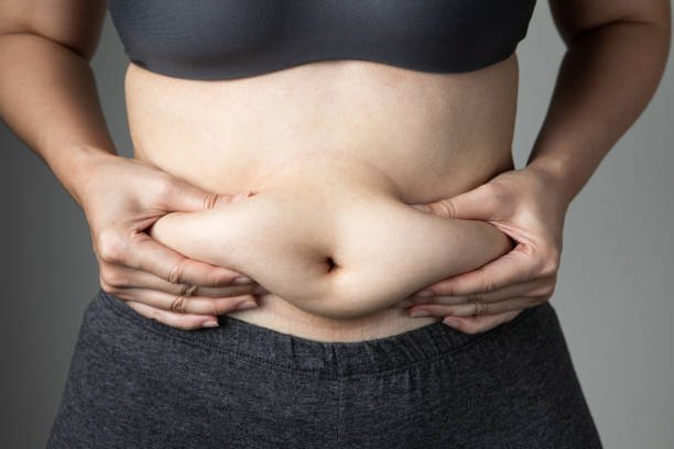 Does Coolsculpting Work on Genetically Resistant Body Fat