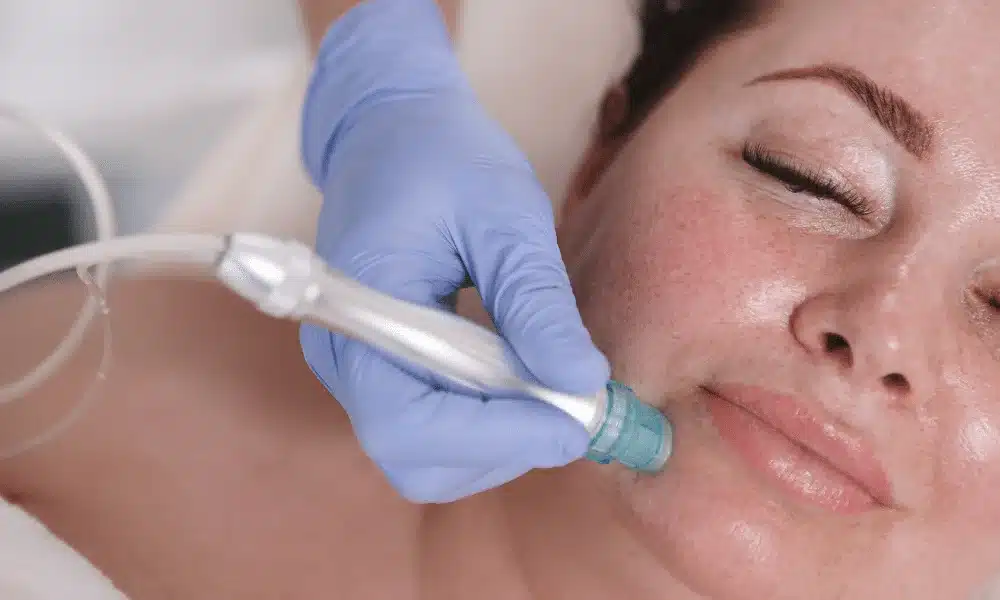 Large Pores Treatment in Abu Dhabi