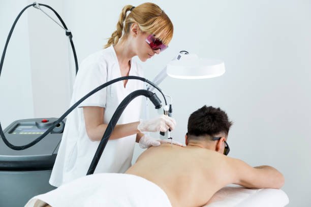 Does Men’s Laser Hair Removal Work on Fine Hair
