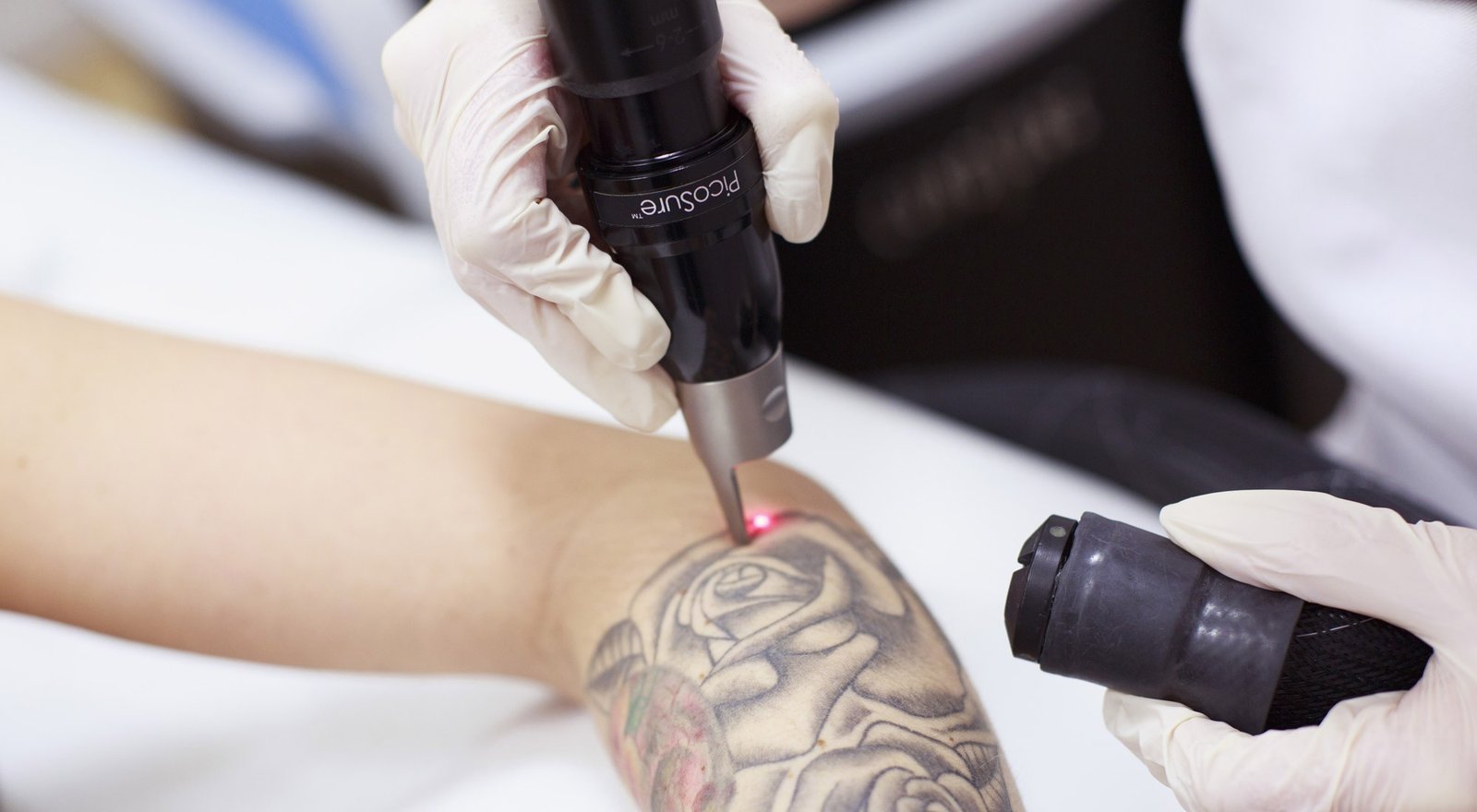 Picosure Tattoo Removal in Abu Dhabi