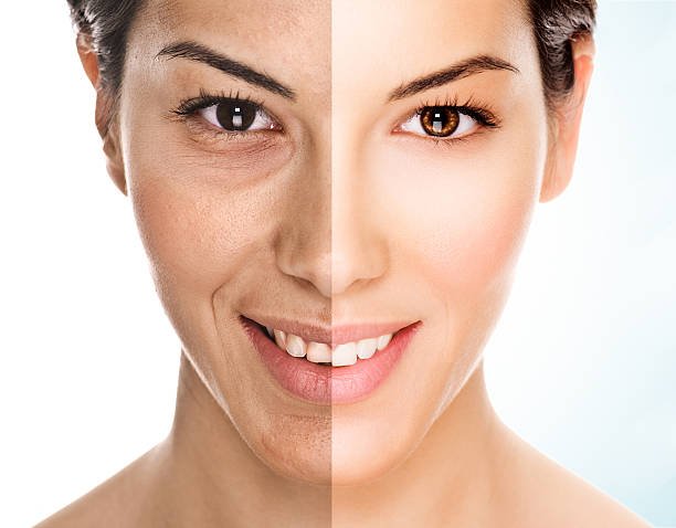 Facelift Surgery in Riyadh