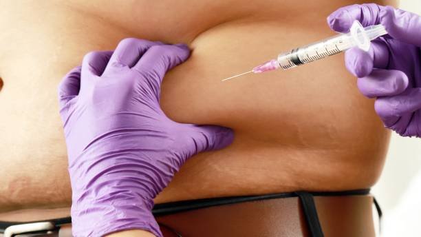 Fat Melting Injections in Riyadh