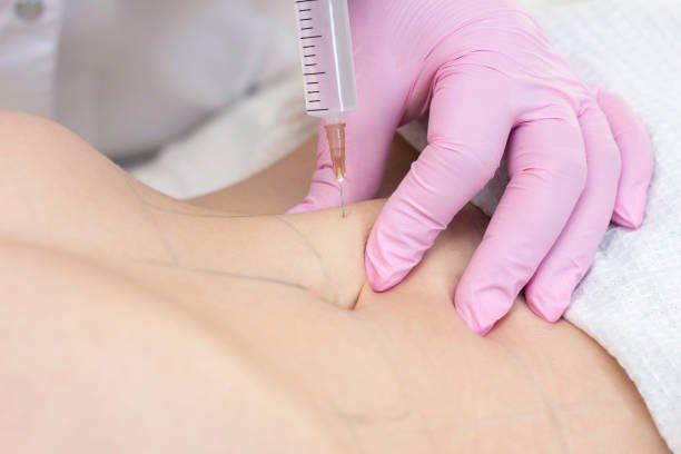 Fat dissolving injection price