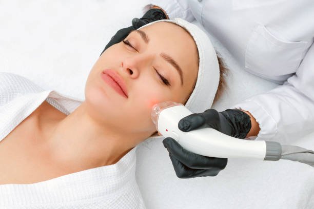How Does Pico Laser Treatment Support Skin Renewal