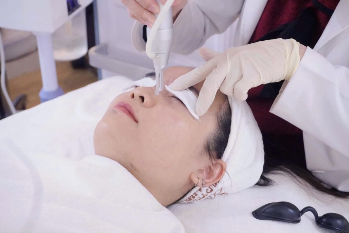 Fractional CO2 laser treatment Abu Dhabi