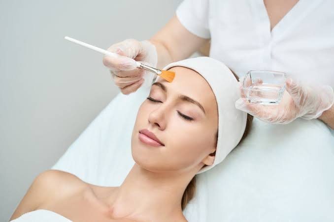 Is Chemical Peels Good for Acne-Prone Skin