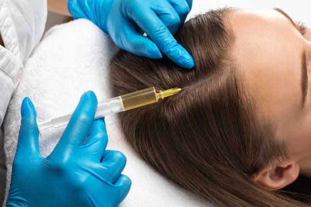 Is PRP Treatment Effective for Hair Regrowth