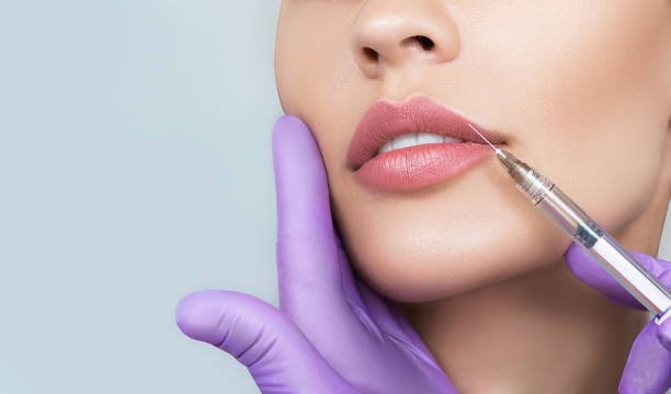Lip Augmentation in Riyadh