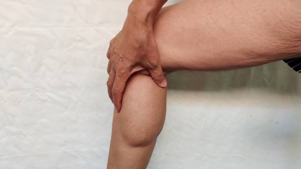Lipedema in Riyadh