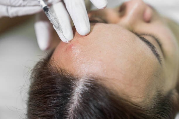 PRP Hair Treatment in Riyadh