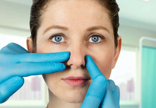Rhinoplasty in Riyadh