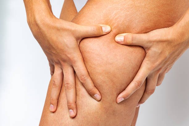 Thigh Lift Surgery in Riyadh