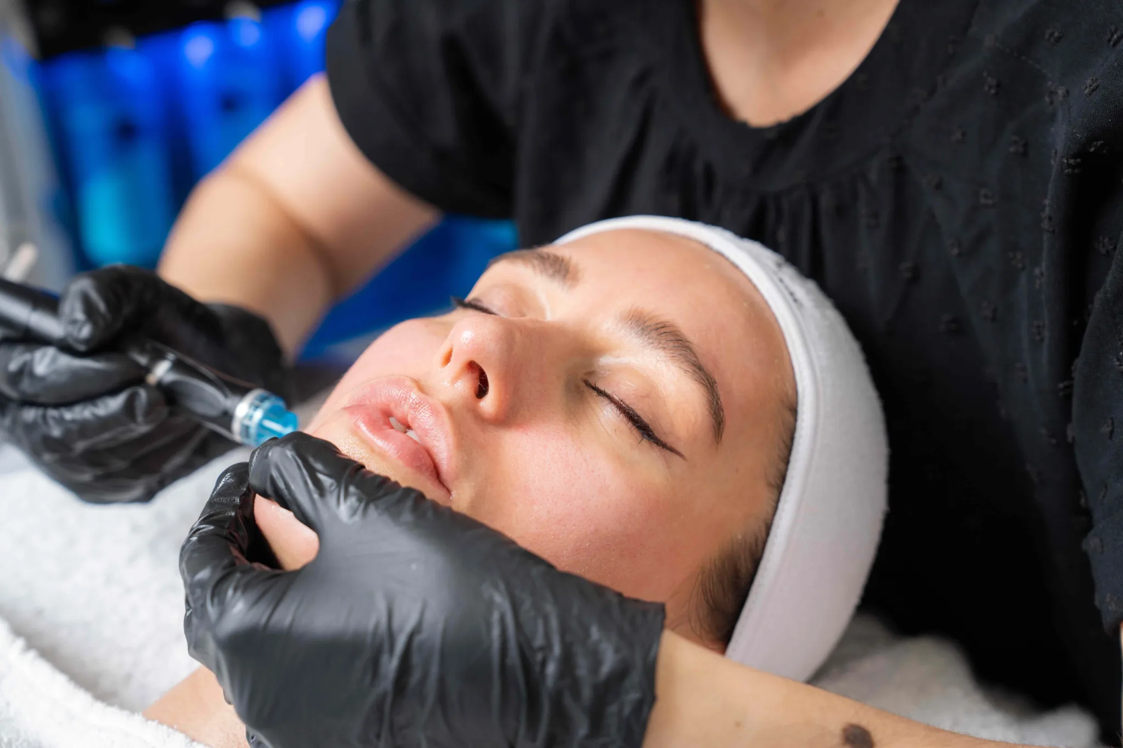 Dermapen treatment in Abu Dhabi