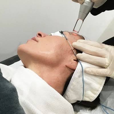 What Results Can Pico Laser Treatment Provide